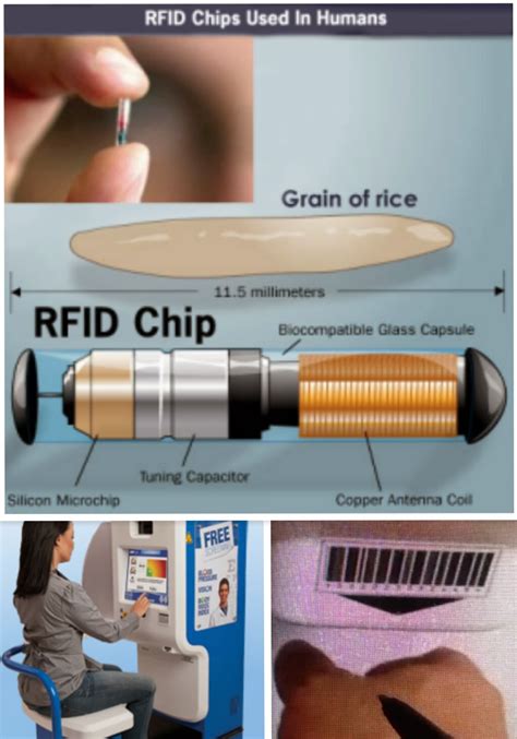 the first person to get an rfid chip|how to get rfid implanted.